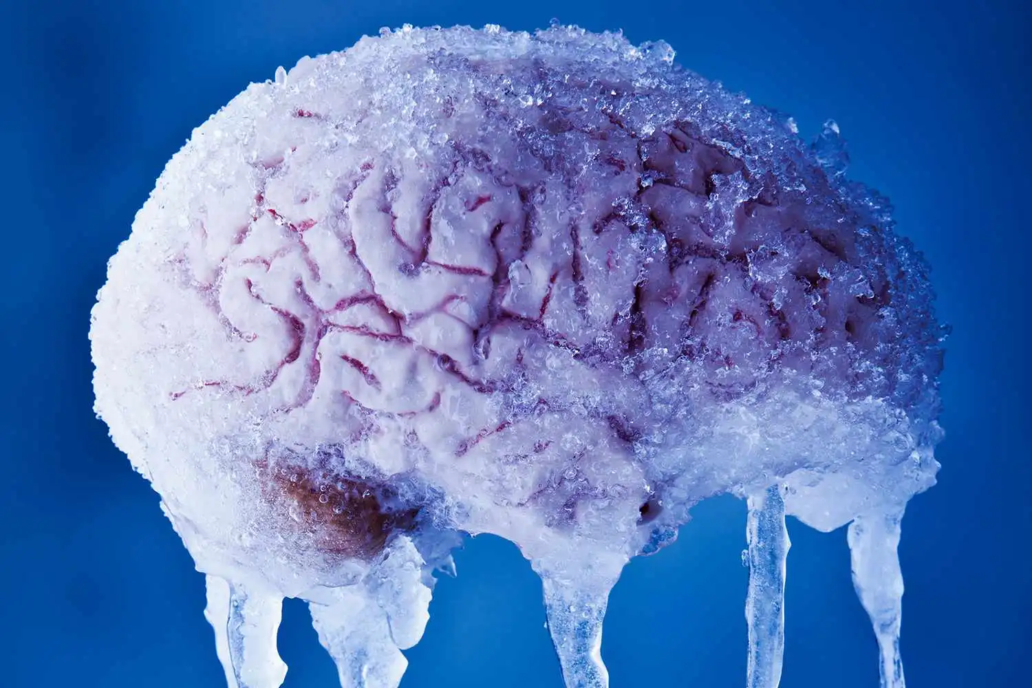 You are currently viewing The Chilly Mystery of Brain Freeze Unveiled